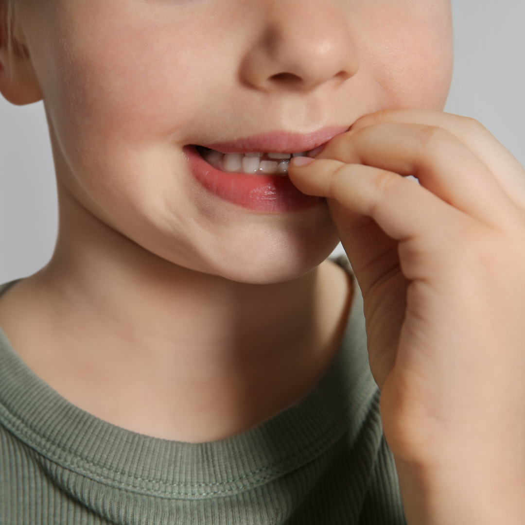 anxiete enfant Image